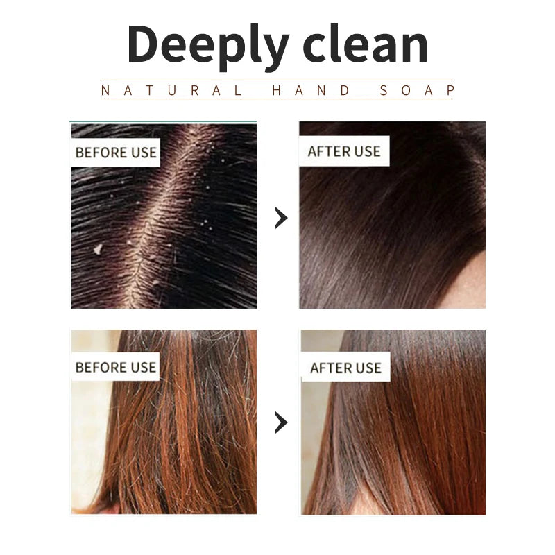 Shampoing Végétal à l’Huile Essentielle d’Arbre à Thé – Pureté, Fraîcheur & Force