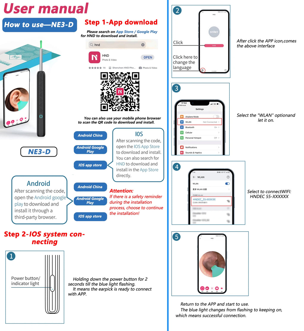 Nettoyeur Visuel de Cire d’Oreille avec Caméra – Kit de Soins Intelligent