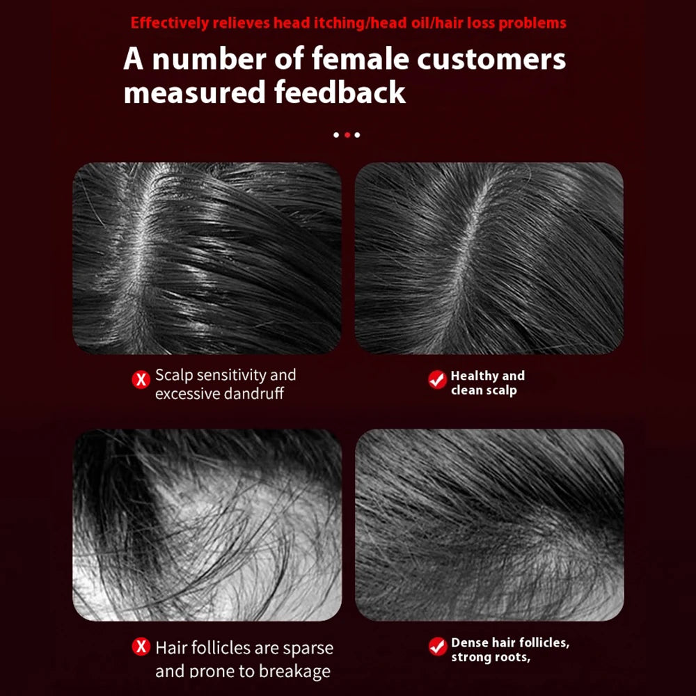 Peigne de Massage Électrique à Vibrations – Thérapie Lumière Rouge & Croissance des Cheveux - USB Inclus