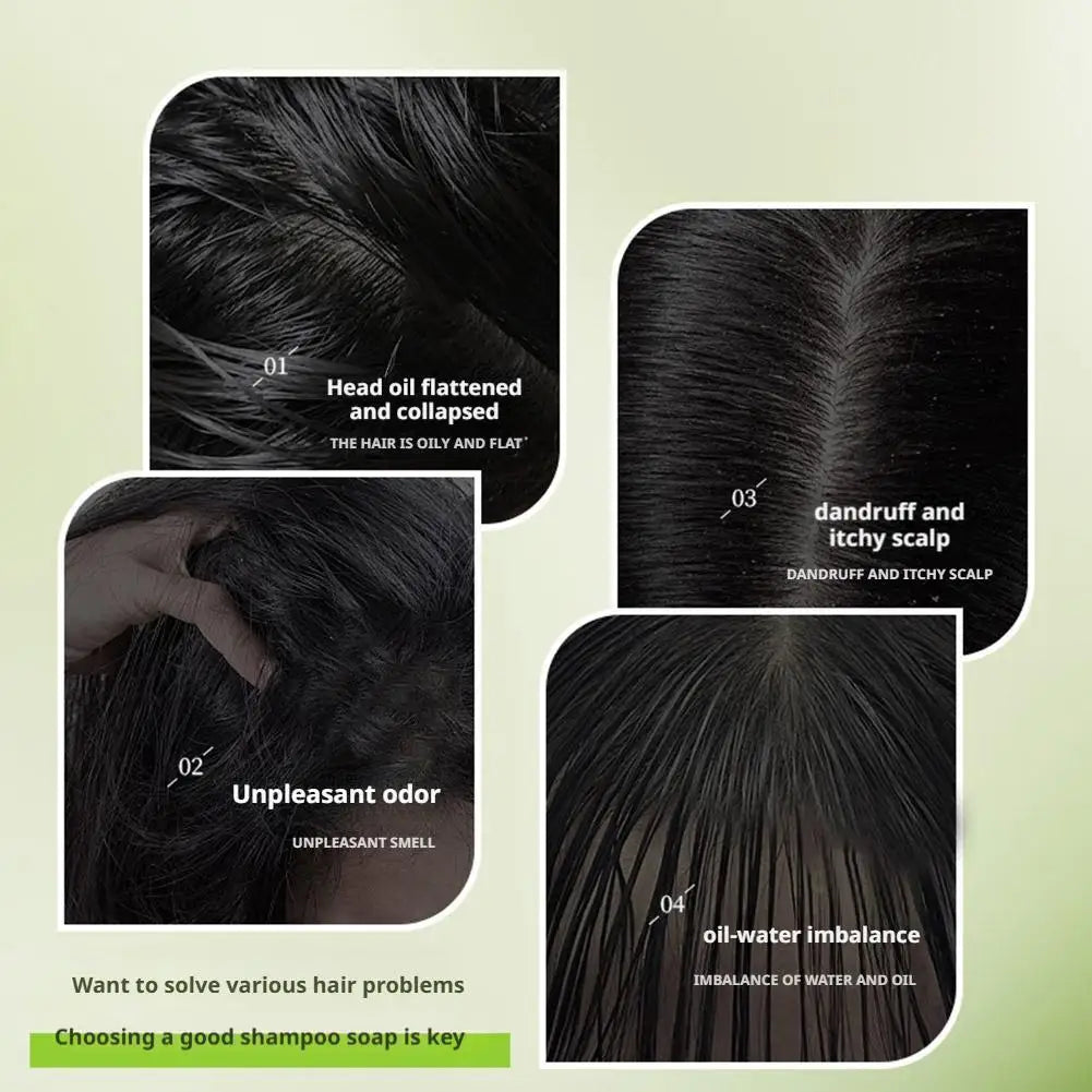 Usman Grass & Platycladus Shampoo Bar Hair Growth Natural Hair Loss Treat Strengthens Roots Control Oil Cleanses Scalp Soap NEW