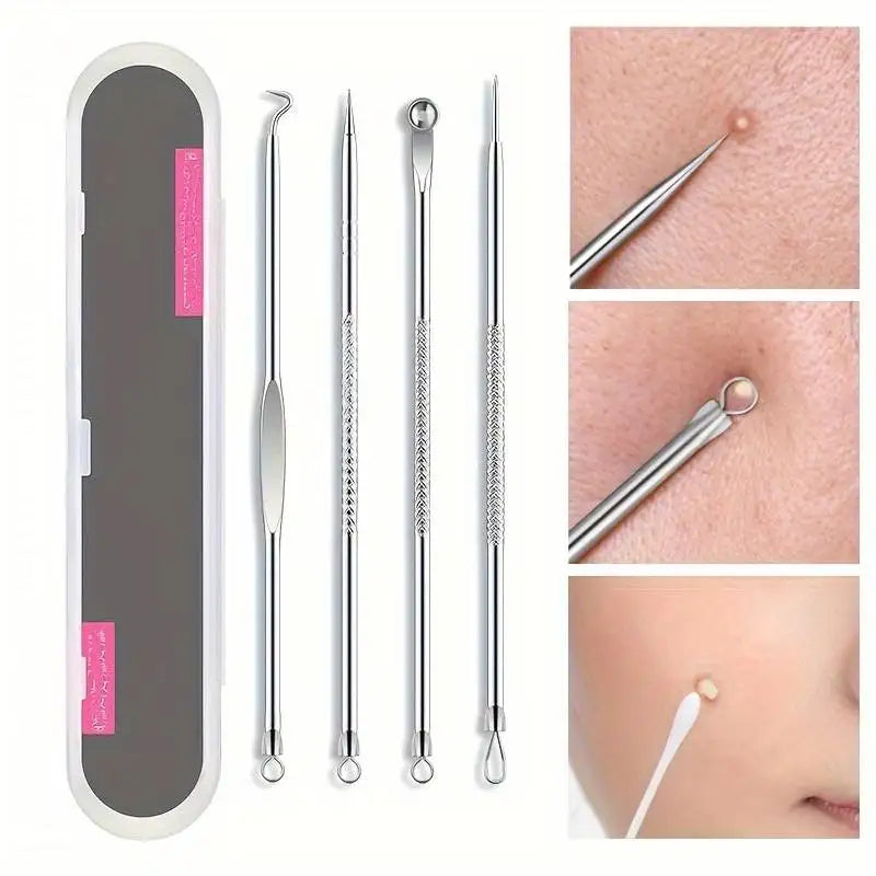Kit D'Outils Pour Points Noirs, Nettoyant De Pores, Crochets Et Dissolvants De Boutons, Soins De La Peau, Non Parfumé, 4 Pièces/Ensemble