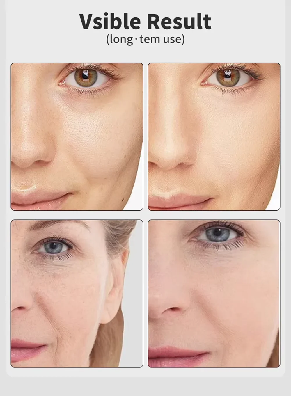 Masseur Facial à Microcourant EMS – Age-R Booster Pro, Skin Care & Rajeunissement