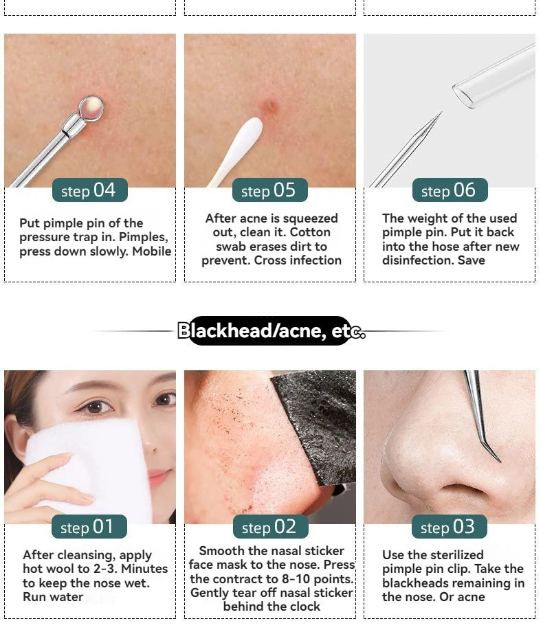 Kit D'Outils Pour Points Noirs, Nettoyant De Pores, Crochets Et Dissolvants De Boutons, Soins De La Peau, Non Parfumé, 4 Pièces/Ensemble